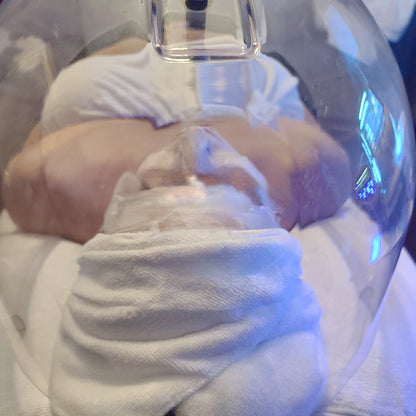 Oxygen Dome Facial